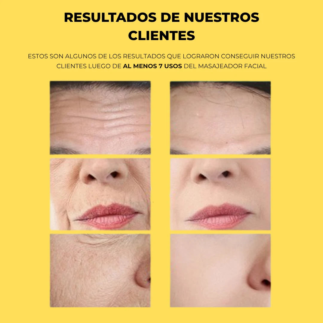 Masajeador Facial "Delfin"